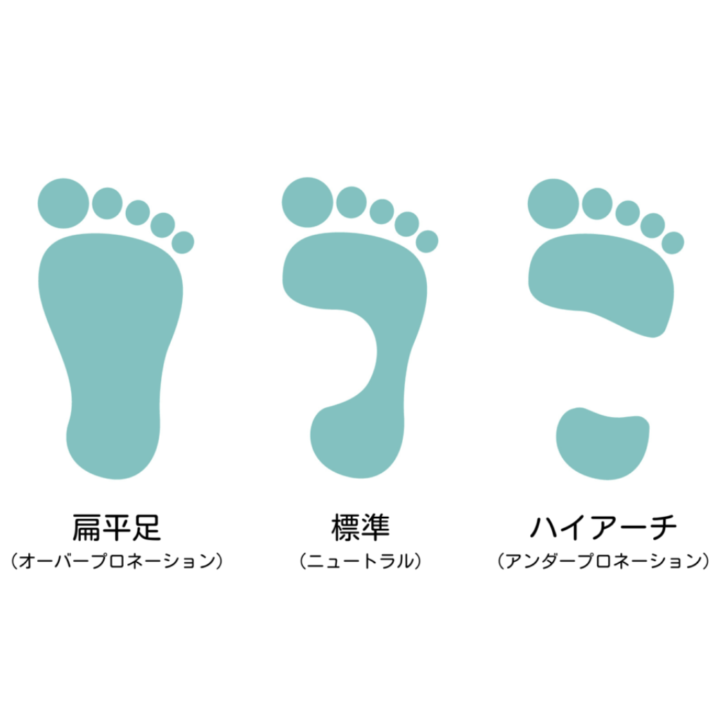 足のタイプの簡易診断「ウェットテスト」の結果を示す図解イラスト